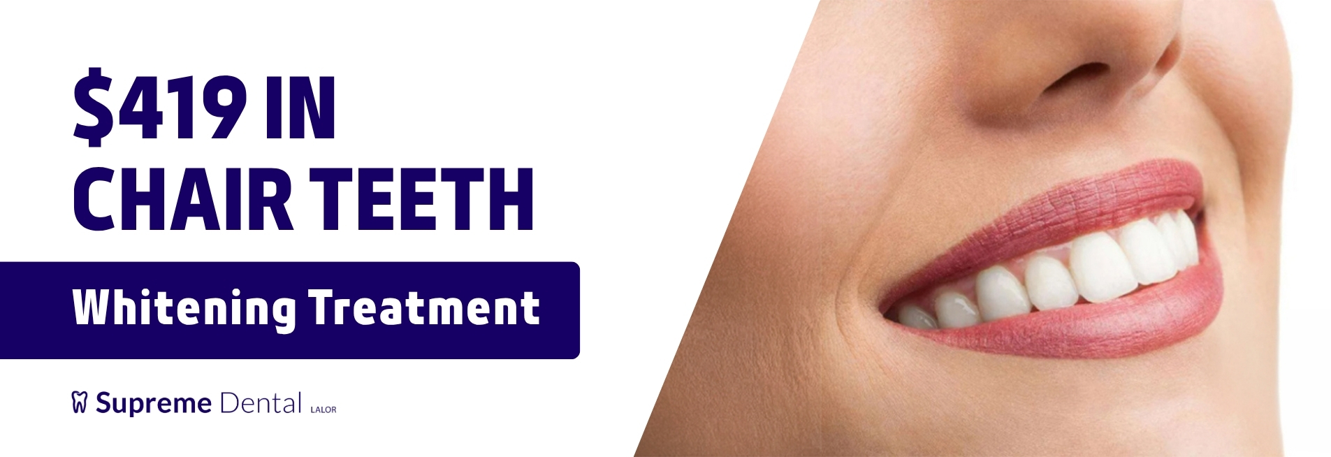 Supreme Dental_Lalor_Canva Banner_Price change