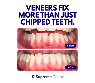 Supreme-Dental_Mobile-Banner_1